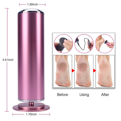 Electric Callus Remover